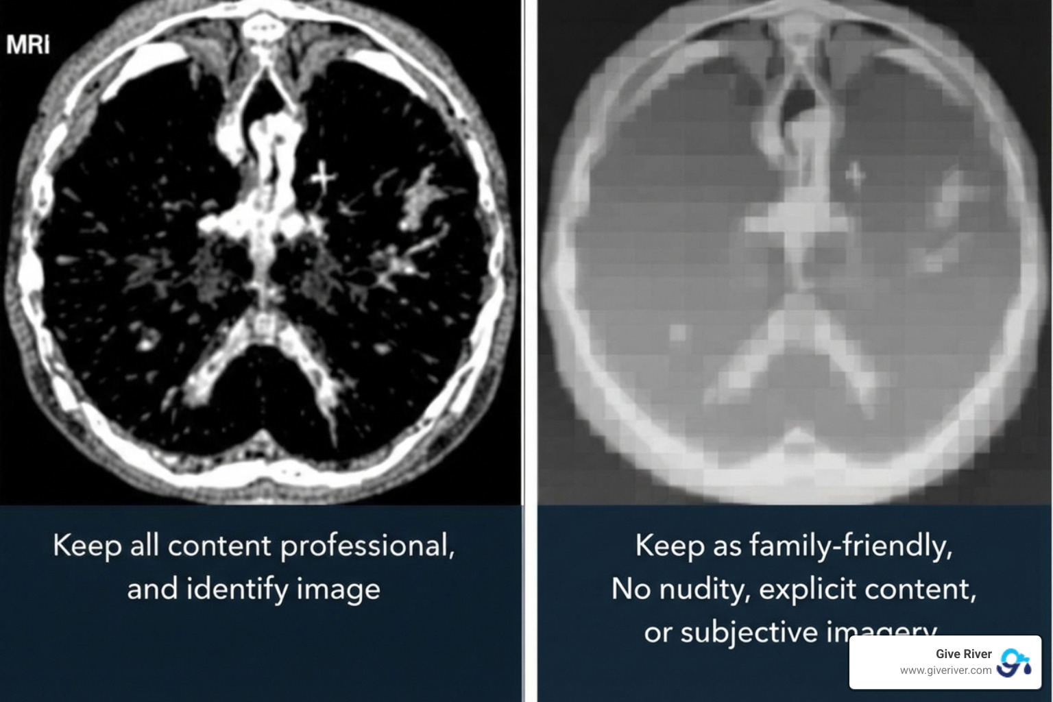 Medical image before and after anonymization with PHI blurred - anonymized health data