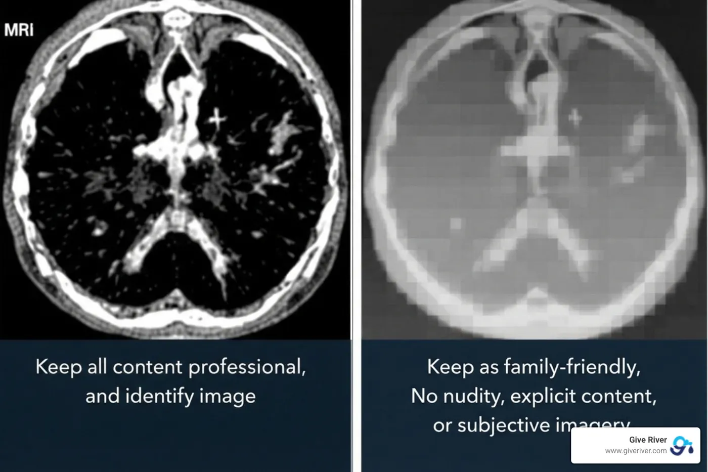 Medical image before and after anonymization with PHI blurred - anonymized health data